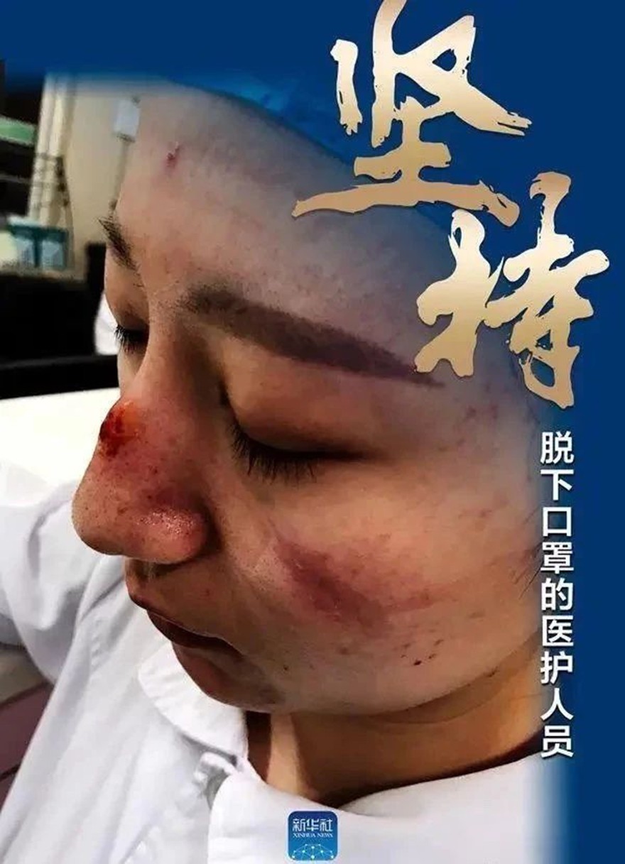 口罩-白鹿寺慈善基金会从印度购得医用n95口罩4万只，支援一线医护人员！
